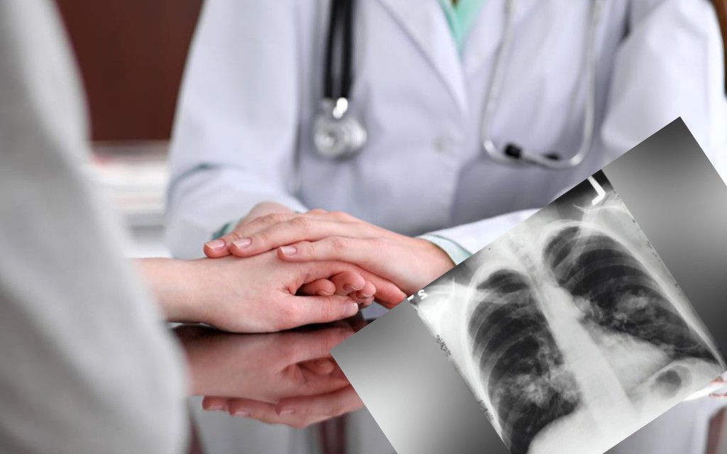 Potresno pismo pacijenta koji boluje od raka pluća: Između smrti, groblja i života stoje oni
