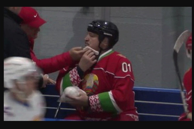 Lukašenko povrijeđen na hokejaškoj utakmici, protivnik ga slučajno udario štapom u lice