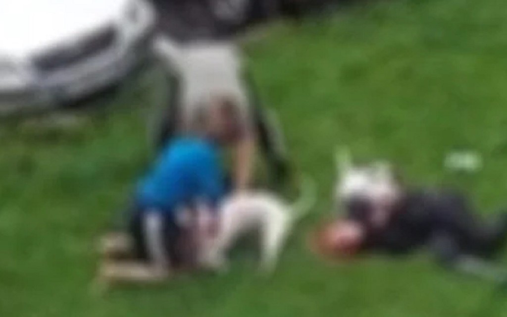 HOROR U KOZARSKOJ DUBICI: Pas napao i izgrizao dva djeteta na igralištu, mještani u strahu