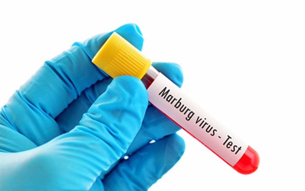 Pacijent negativan na testu, Marburška bolest nije stigla u Evropu