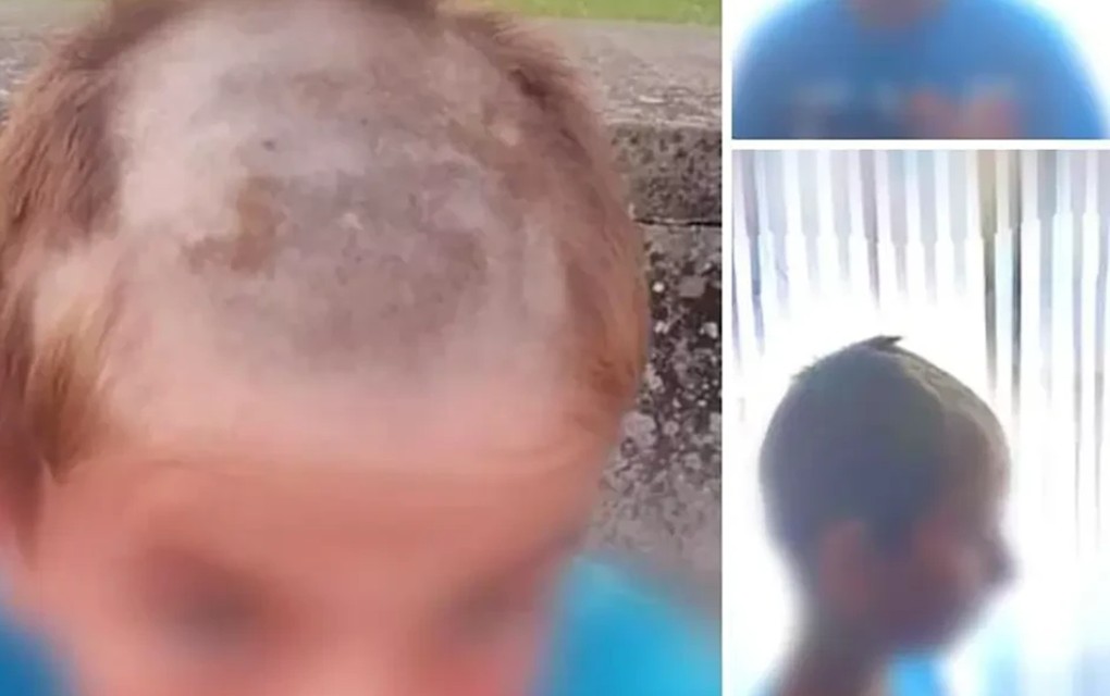 Užas u Hrvatskoj: Dječaka usred dana uhvatili i na silu ošišali