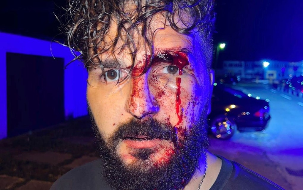 Novinar iz Brčkog u sačekuši napadnut i pretučen