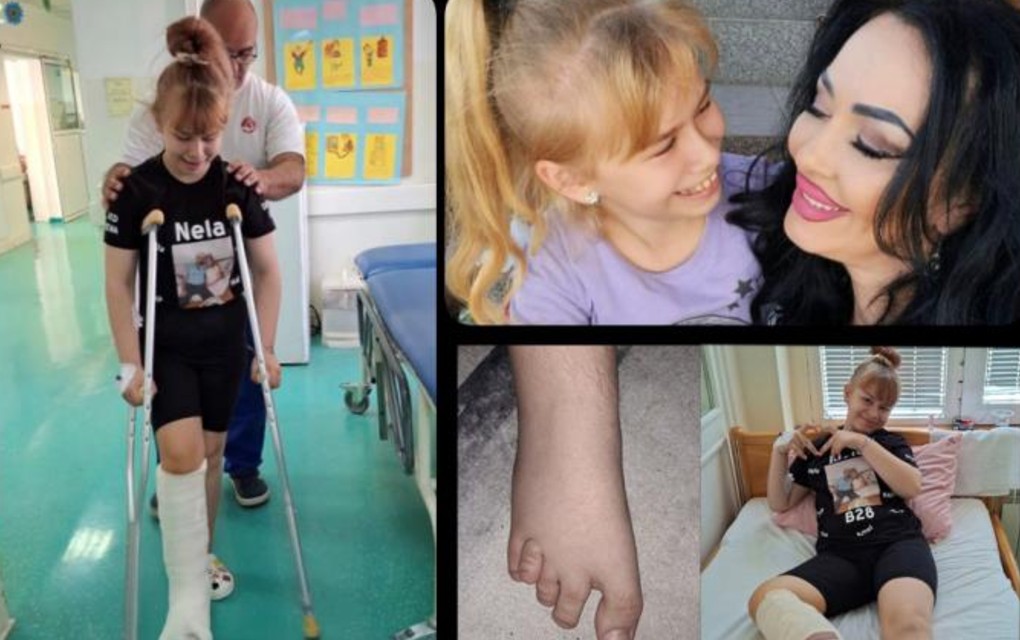 Irma (12) iz okoline Tuzle nije mogla operaciju ni u BiH, ni u Rijeci, urađena u Tiršovoj! Mama: Rušimo predrasude Dr Bukva: Uzeo sam s njene potkolenice…