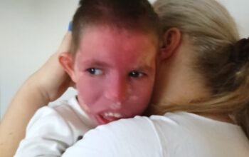 Dušanu Pavičaru (9) iz Trna potrebna pomoć dobrih ljudi