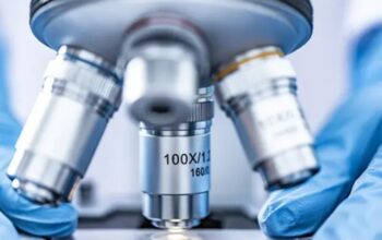 U Srpskoj otkriven tifus