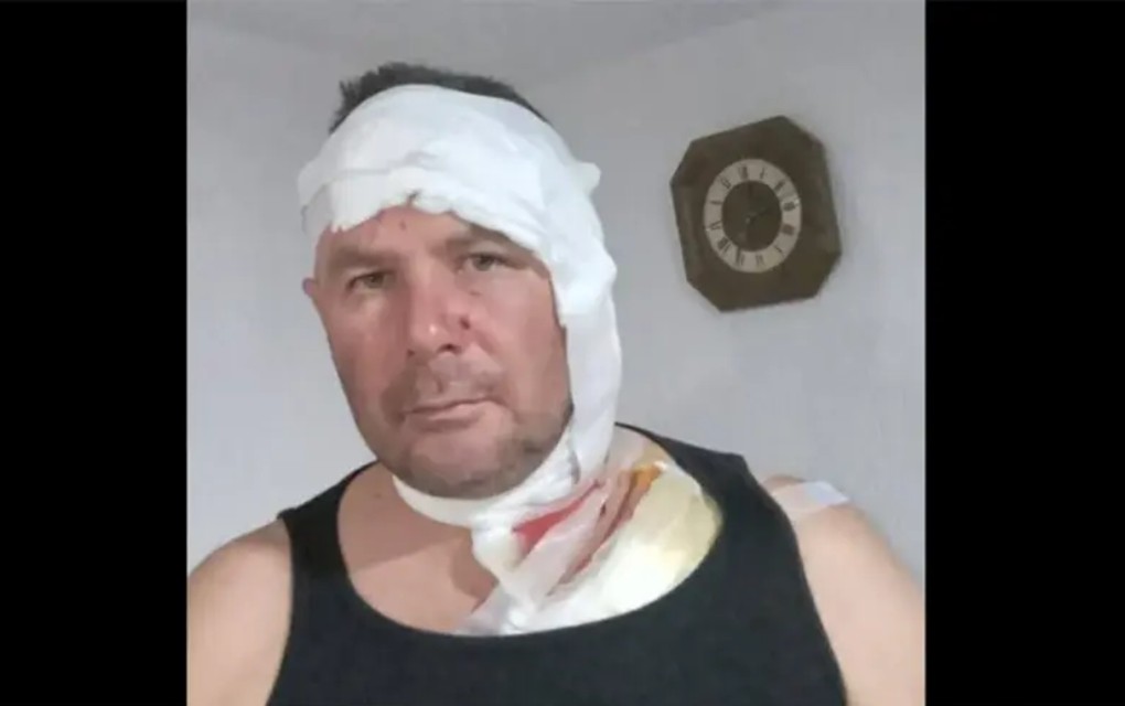 Lovac iz BiH preživio napad mečke: Skočila je na mene