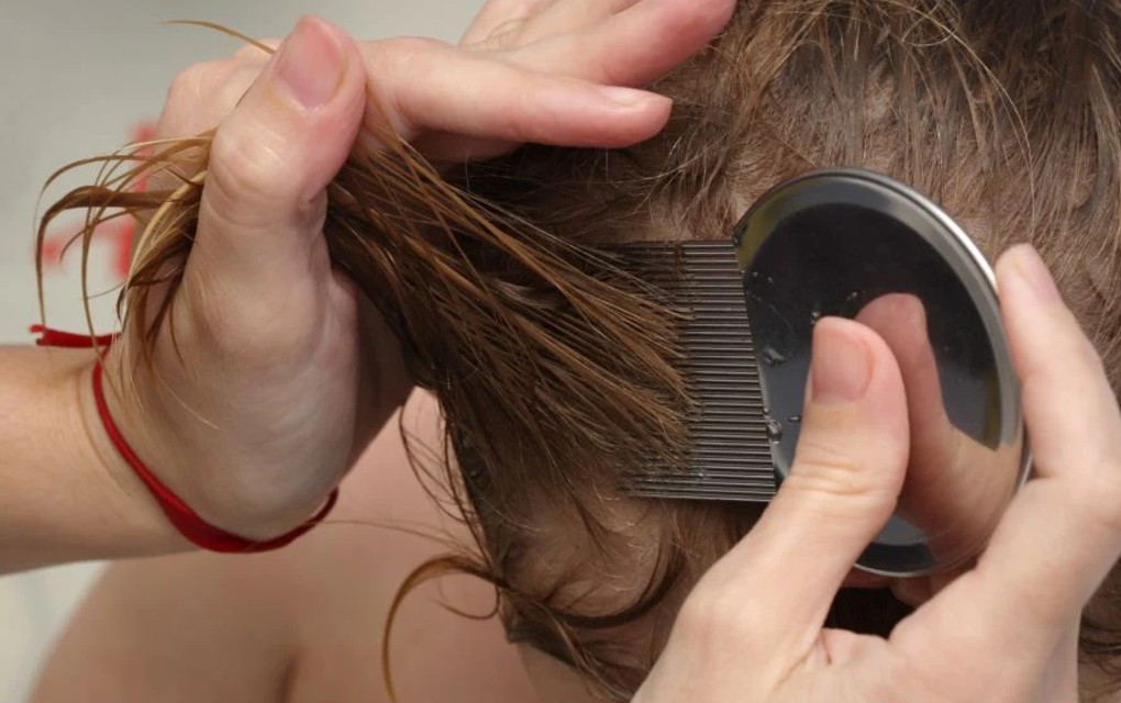 U pet banjalučkih vrtića i jednoj školi pojavile se vaške